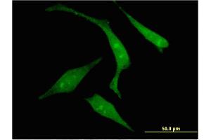 Immunofluorescence of monoclonal antibody to RGS14 on HeLa cell. (RGS14 Antikörper  (AA 1-566))