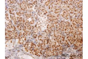 Immunoperoxidase of monoclonal antibody to NCOA4 on formalin-fixed paraffin-embedded human pancreas.