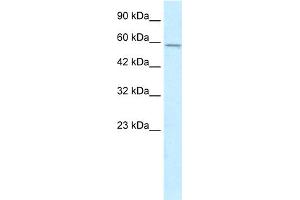 WB Suggested Anti-MGC4618 Antibody Titration:  0. (TMEM175 Antikörper  (N-Term))