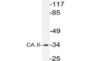 Western blot analysis of Carbonic anhydrase 2 antibody in extracts from rat heart cells. (CA2 Antikörper)