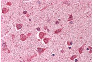 Human Brain, Cortex (formalin-fixed, paraffin-embedded) stained with ING1 antibody ABIN290441 at 2. (ING1 Antikörper  (AA 285-296))