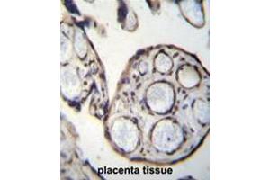 CAPN6 Antibody (Center) immunohistochemistry analysis in formalin fixed and paraffin embedded human placenta tissue followed by peroxidase conjugation of the secondary antibody and DAB staining. (Calpain 6 Antikörper  (Middle Region))