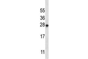IL-22 antibody western blot analysis in K562 lysate (IL-22 Antikörper  (AA 44-73))
