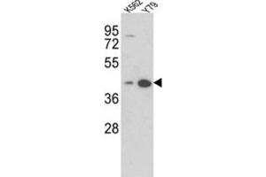 Western Blotting (WB) image for anti-alpha-2-Glycoprotein 1, Zinc-Binding (AZGP1) antibody (ABIN3002718) (AZGP1 Antikörper)