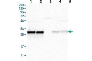 Western blot analysis of Lane 1: RT-4, Lane 2: U-251 MG, Lane 3: Human Plasma, Lane 4: Liver, Lane 5: Tonsil with MRPL45 polyclonal antibody  at 1:250-1:500 dilution. (MRPL45 Antikörper)