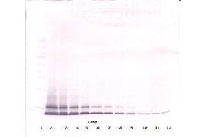 Image no. 1 for anti-Chemokine (C-X-C Motif) Ligand 1 (Melanoma Growth Stimulating Activity, Alpha) (CXCL1) antibody (ABIN465460) (CXCL1 Antikörper)