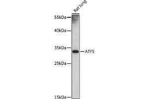 Western blot analysis of extracts of rat lung, using  antibody (ABIN7265407) at 1:1000 dilution. (ATF5 Antikörper)