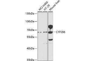 Western blot analysis of extracts of various cell lines, using CYP2B6 antibody (ABIN1679474, ABIN5663912, ABIN5663914 and ABIN6218554) at 1:1000 dilution. (CYP2B6 Antikörper  (AA 160-340))