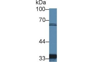 Detection of SLC30A8 in Human Hela cell lysate using Polyclonal Antibody to Solute Carrier Family 30 Member 8 (SLC30A8) (SLC30A8 Antikörper  (AA 263-369))