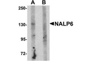 Western blot analysis of NALP5 in mouse brain tissue lysate with NALP5 antibody at 1 μg/ml in (A) the absence and (B) the presence of blocking peptide. (NLRP6 Antikörper  (N-Term))