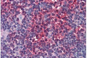 anti-Arrestin, beta 2 (ARRB2) (AA 300-410) antibody