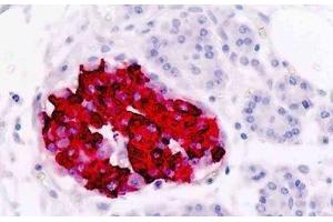 Human Pancreas, Islets of Langerhans: Formalin-Fixed, Paraffin-Embedded (FFPE) (Insulin Antikörper)
