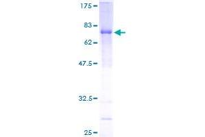 Image no. 1 for Interferon-Induced Protein 44 (IFI44) (AA 1-444) protein (GST tag) (ABIN1307414) (IFI44 Protein (AA 1-444) (GST tag))