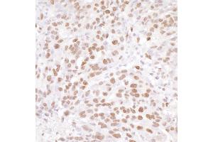 anti-Nuclear Casein Kinase and Cyclin-Dependent Kinase Substrate 1 (NUCKS1) (AA 147-197) antibody