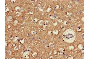 Immunohistochemistry of paraffin-embedded human brain tissue using ABIN7166533 at dilution of 1:100