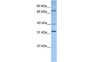 WB Suggested Anti-SUZ12 Antibody Titration:  0. (SUZ12 Antikörper  (Middle Region))