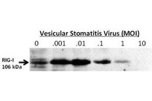 Western blot testing of RIG-I antibody 24-hour post infection of primary murine microglia cells (2x10e6) untreated (0) or exposed to vesicular stomatitis virus at a range of viral particle/cell ratios. (DDX58 Antikörper  (AA 894-925))
