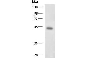 Western blot analysis of Mouse kidney tissue lysate using FOXQ1 Polyclonal Antibody at dilution of 1:650 (FOXQ1 Antikörper)