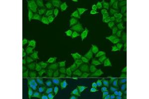 Immunofluorescence analysis of U2OS cells using ATP5J Polyclonal Antibody at dilution of 1:100. (ATP5J Antikörper)