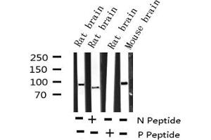 Western blot analysis of Phospho-Dynamin-1 (Ser774) expression in various lysates