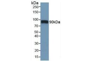 Detection of CD36 in Mouse Heart Tissue using Polyclonal Antibody to Cluster Of Differentiation 36 (CD36) (CD36 Antikörper  (AA 45-203))