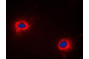 Immunofluorescent analysis of NIP1 staining in COLO205 cells. (BNIP1 Antikörper  (C-Term))