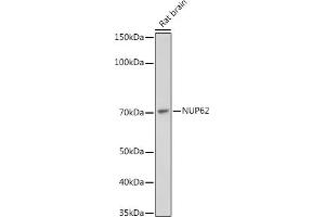 Western blot analysis of extracts of Rat brain, using NUP62 antibody (ABIN7269045) at 1:1000 dilution. (NUP62 Antikörper)