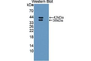 Western blot analysis of the recombinant protein. (RETNLB Antikörper  (AA 24-111))
