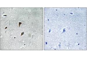 Immunohistochemistry analysis of paraffin-embedded human brain, using MAP2K3 (Phospho-Thr222) Antibody. (MAP2K3 Antikörper  (pThr222))