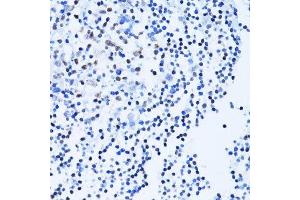 Immunohistochemistry of paraffin-embedded human tonsil using PARP1 antibody. (PARP1 Antikörper  (AA 81-390))