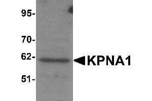 Western Blotting (WB) image for anti-Karyopherin alpha 1 (Importin alpha 5) (KPNA1) (N-Term) antibody (ABIN1031429) (KPNA1 Antikörper  (N-Term))