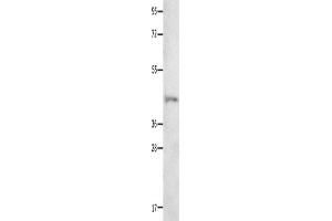Western Blotting (WB) image for anti-Neurotensin Receptor 1 (High Affinity) (NTSR1) antibody (ABIN2426287) (NTSR1 Antikörper)