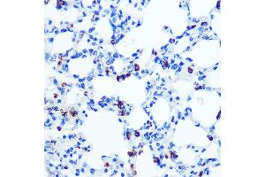 Immunohistochemistry (IHC) image for anti-Golgin A2 (GOLGA2) antibody (ABIN7267494)