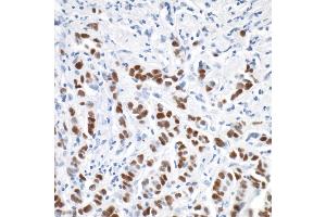 Immunohistochemistry (IHC) image for anti-Progesterone Receptor (PGR) antibody (ABIN7455133)