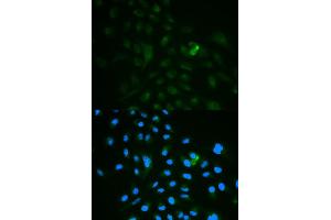 Immunofluorescence analysis of MCF7 cell using CD79B antibody. (CD79b Antikörper)