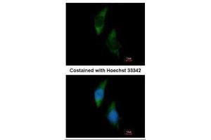 ICC/IF Image Immunofluorescence analysis of methanol-fixed HeLa, using FARSLA, antibody at 1:200 dilution. (Phenylalanyl-tRNA Synthetase, alpha Subunit (FARSA) Antikörper)