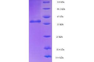 SDS-PAGE (SDS) image for RAN, Member RAS Oncogene Family (RAN) (AA 2-219) protein (His-SUMO Tag) (ABIN5710886)