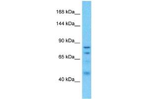Host:  Rabbit  Target Name:  CGN  Sample Type:  Uterus Tumor lysates  Antibody Dilution:  1. (Cingulin Antikörper  (N-Term))