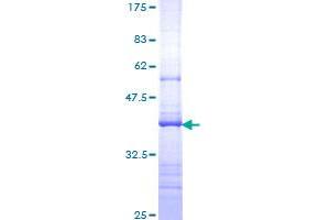 Image no. 1 for Interleukin 17 Receptor A (IL17RA) (AA 33-132) protein (GST tag) (ABIN1307715)
