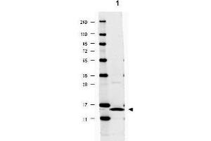 Image no. 2 for anti-Interleukin 17A (IL17A) antibody (ABIN401113) (Interleukin 17a Antikörper)