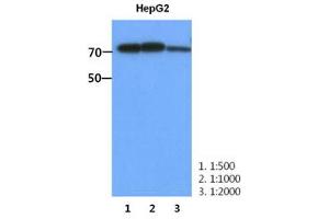 Image no. 1 for anti-phosphofructokinase, Muscle (PFKM) antibody (ABIN1490780) (PFKM Antikörper)
