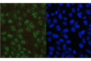 IF analysis of PAX5 using anti-PAX5 antibody (ABIN7600655).