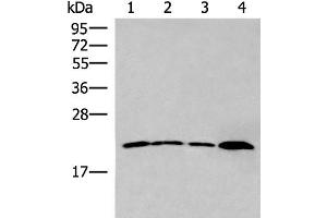 Western blot analysis of 231 cell Human breast cancer tissue Raji cell Human fetal liver tissue lysates using IFNA5 Polyclonal Antibody at dilution of 1:400 (IFNA5 Antikörper)