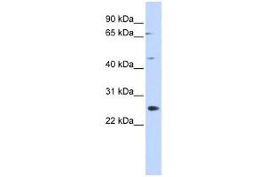 Western Blotting (WB) image for anti-Spermatogenesis Associated 22 (SPATA22) antibody (ABIN2460089) (SPATA22 Antikörper)