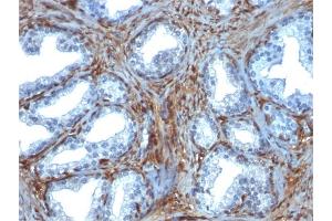 Immunohistochemistry (IHC) image for anti-Lectin, Galactoside-Binding, Soluble, 1 (LGALS1) (AA 12-108) antibody (ABIN6939958)