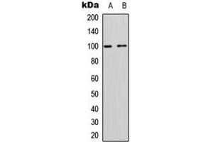 Western blot analysis of CD167a expression in Jurkat (A), rat muscle (B) whole cell lysates. (DDR1 Antikörper  (C-Term))