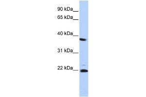 Western Blotting (WB) image for anti-Proteasome (Prosome, Macropain) Subunit, beta Type 2 (PSMB2) (Middle Region) antibody (ABIN2786715)