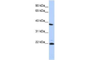 WB Suggested Anti-PSMB2 Antibody Titration: 0. (PSMB2 Antikörper  (Middle Region))