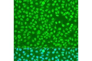 Immunofluorescence analysis of U2OS cells using HNRNPDL Polyclonal Antibody at dilution of 1:100. (HNRPDL Antikörper)