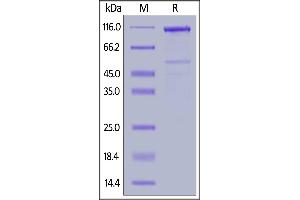 Human LRP-6 (20-630), Mouse IgG2a Fc Tag on  under reducing (R) condition. (LRP6 Protein (AA 20-630) (Fc Tag))